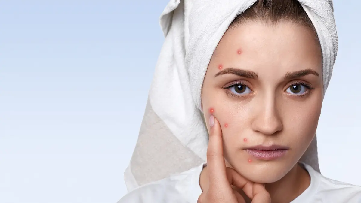 Best Dermatology hospital in chennai | CTS Hospitals