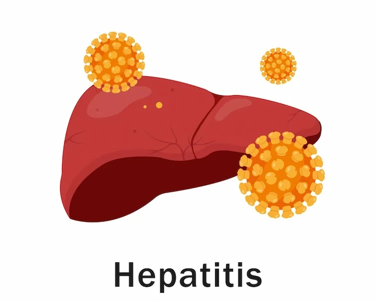 best treatment for Hepatitis B in Chennai | CTS Hospitals
