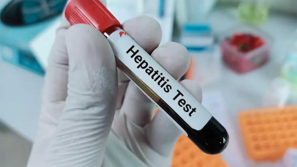 best treatment for hepatitis C in Chennai | CTS Hospitals