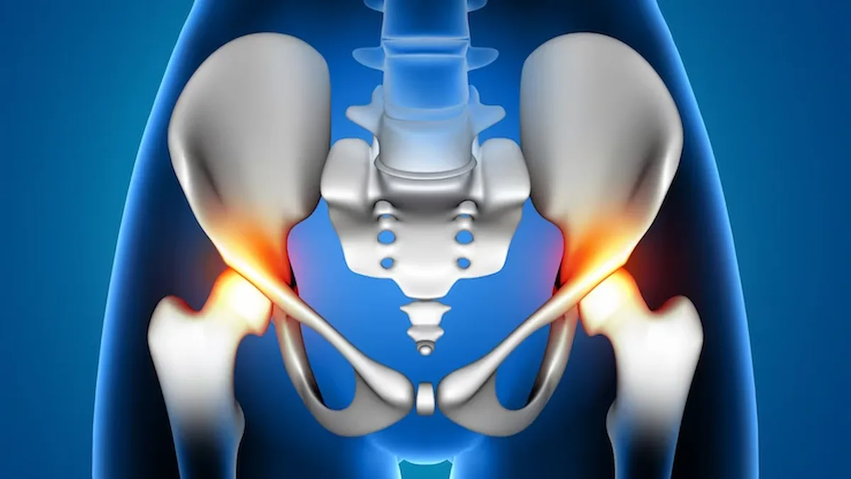 Best Hip Replacement Surgery In Chennai Expert Care