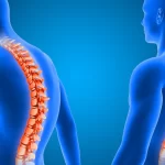 spine surgery in Chennai | CST Hospitals