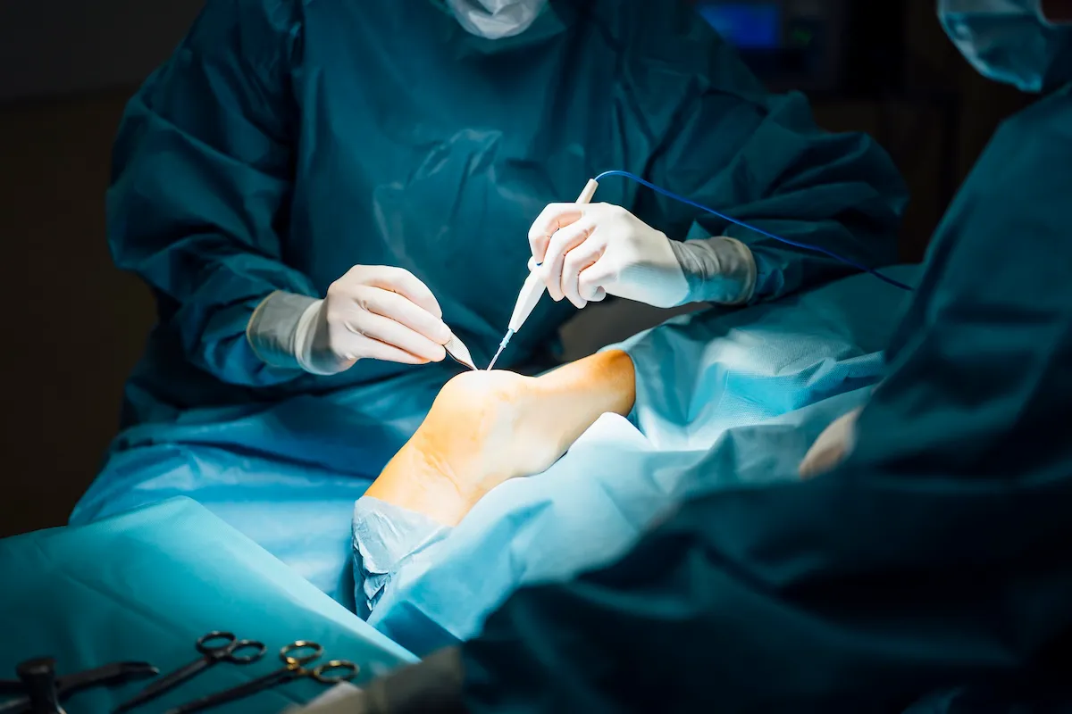 foot and ankle surgery in Chennai | CTS Hospitals