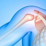 shoulder and elbow replacement surgery in Chennai | CST Hospitals