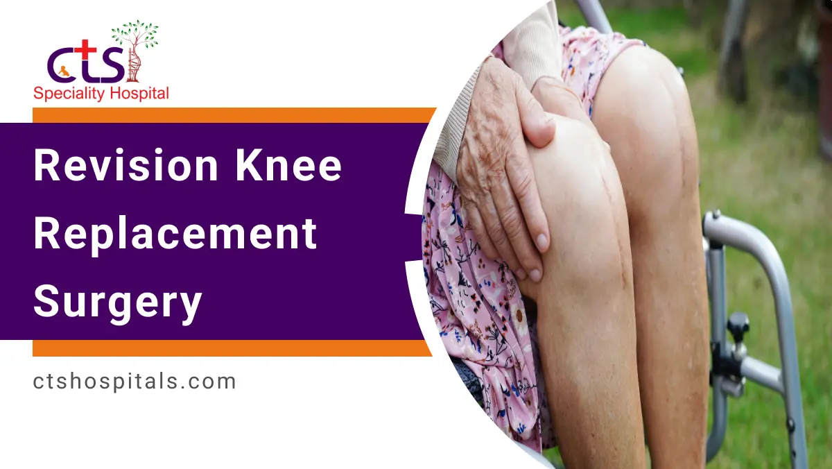 Revision Knee Replacement Surgery
