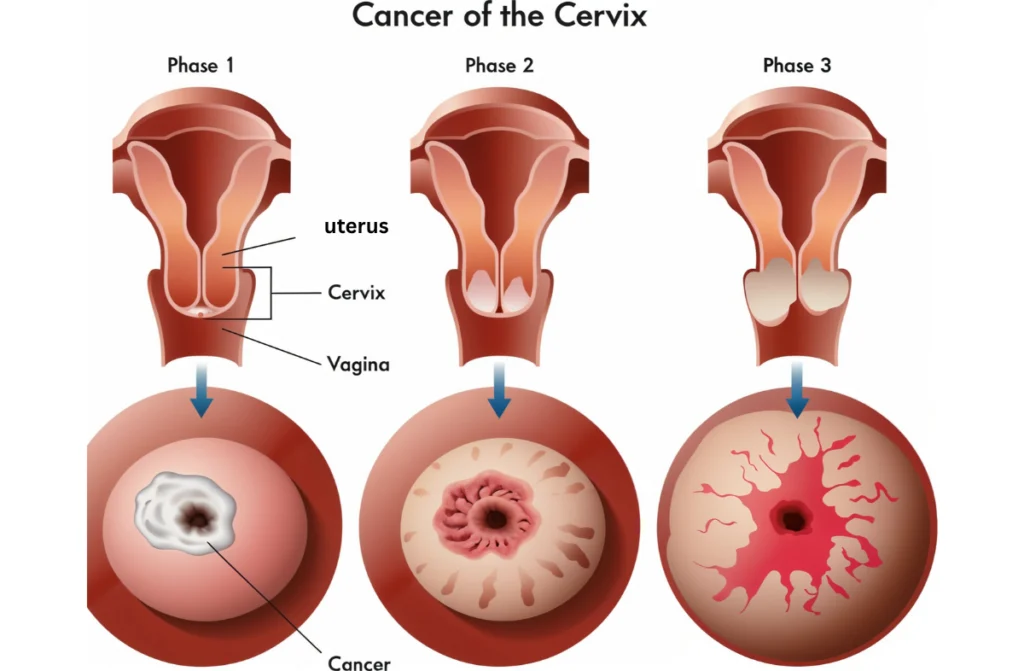 Best Oncologists in Chennai