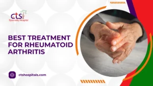 Best Treatment for Rheumatoid Arthritis