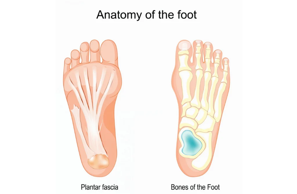 Plantar Fasciitis Treatment in Chennai