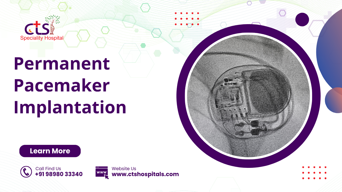 Permanent Pacemaker Implantation