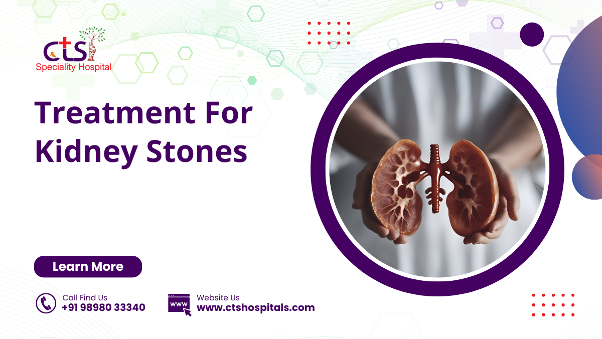Treatment For Kidney Stones