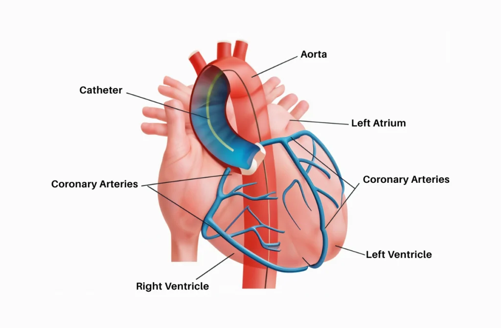 Best Interventional Cardiologist in Chennai