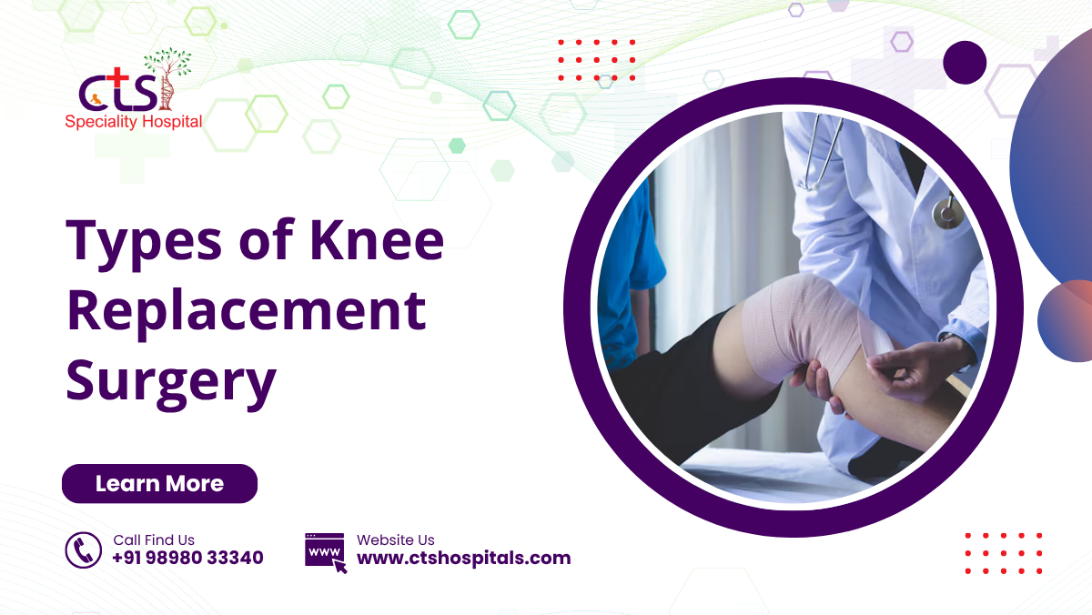 Types of Knee Replacement Surgery