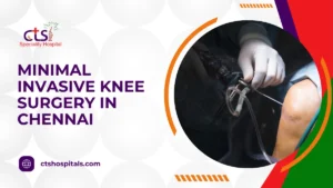 Minimally Invasive Knee Surgery in Chennai