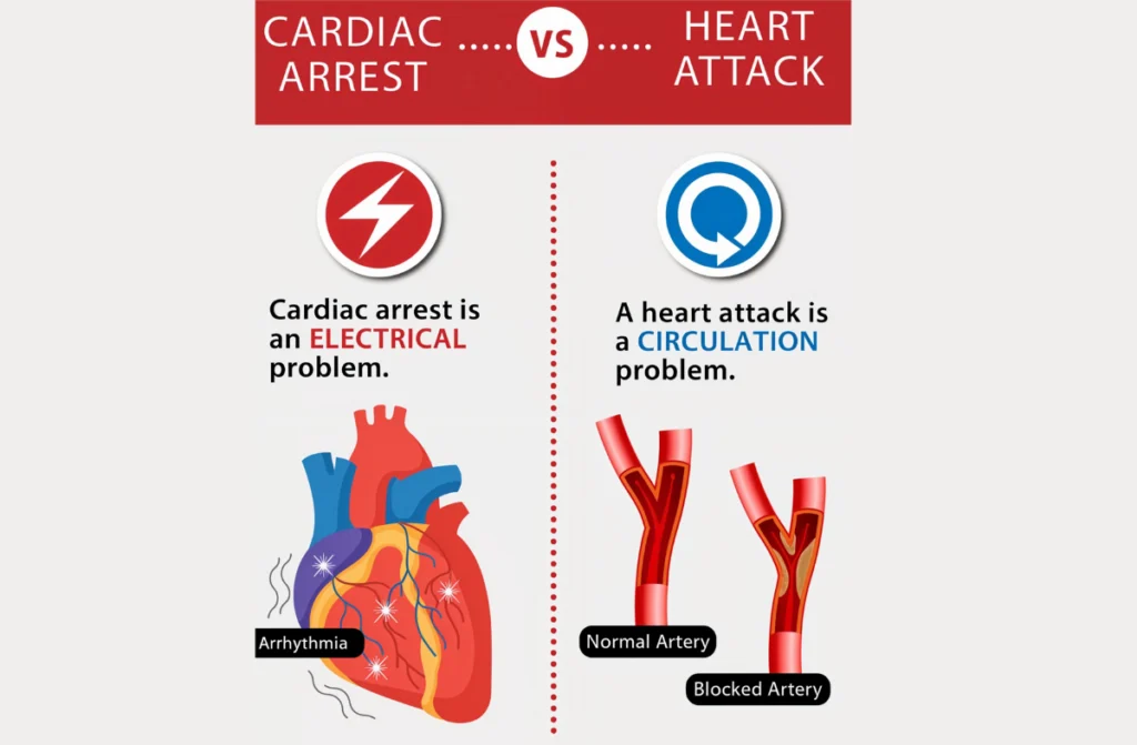 Sudden Cardiac Arrest