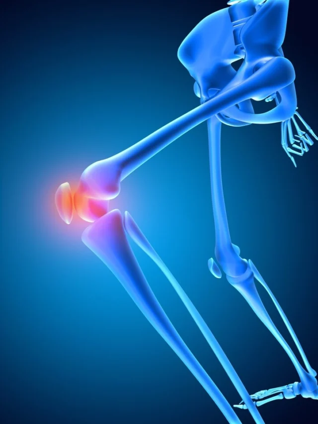 bone health in women