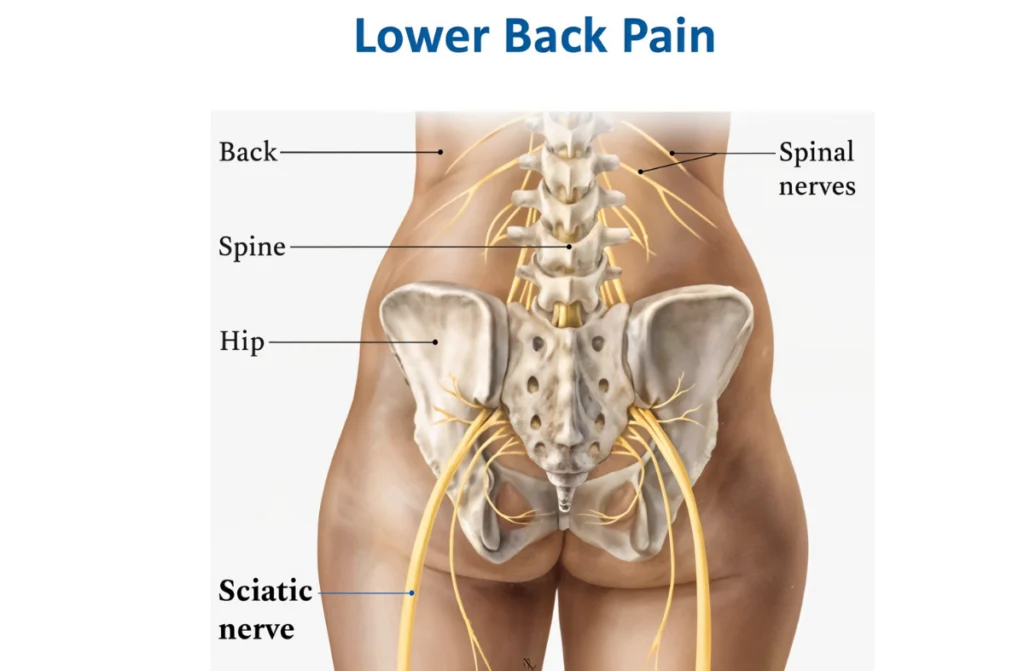 Lower Back Pain