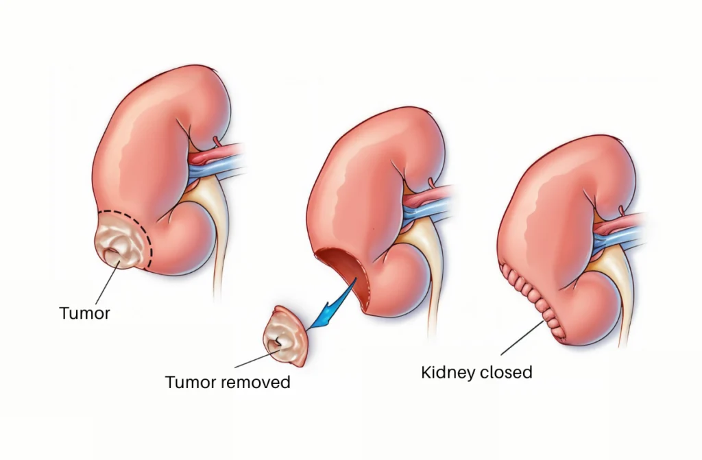 Best Kidney Specialist in Tamilnadu