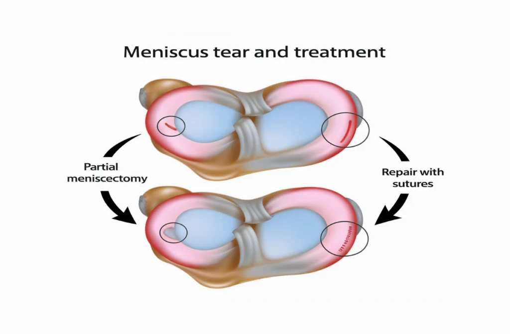 Best Orthopedic Hospitals in Chennai
