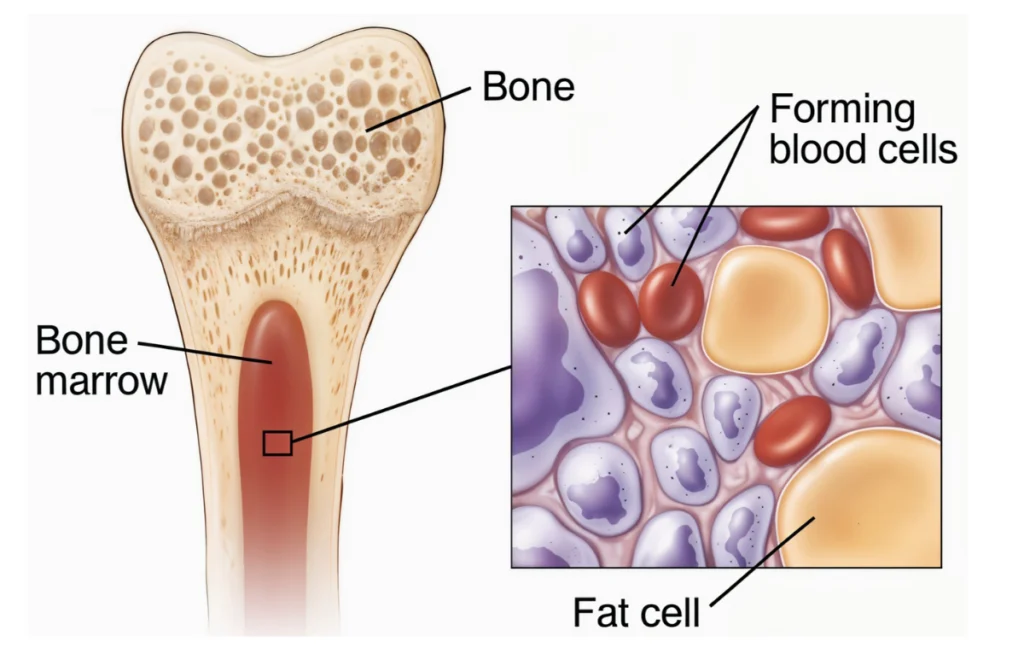 Bone Marrow Transplant Chennai