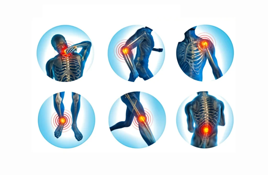 Orthopedic Physical Therapy