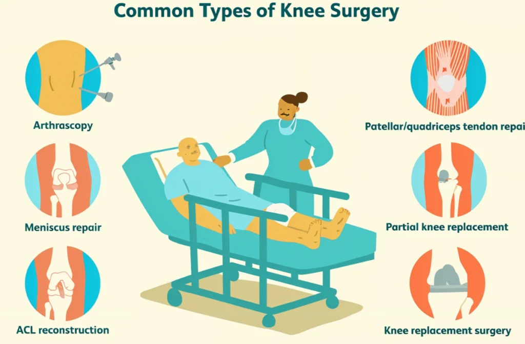 Day Care Orthopaedic Surgeries in Chennai