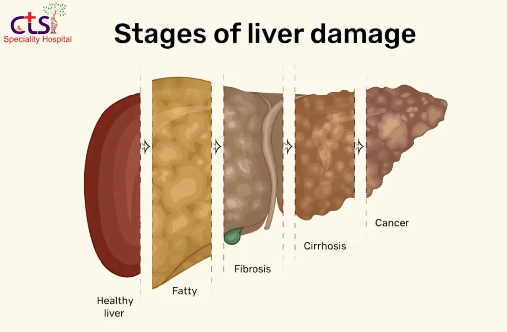 Signs of Liver Damage